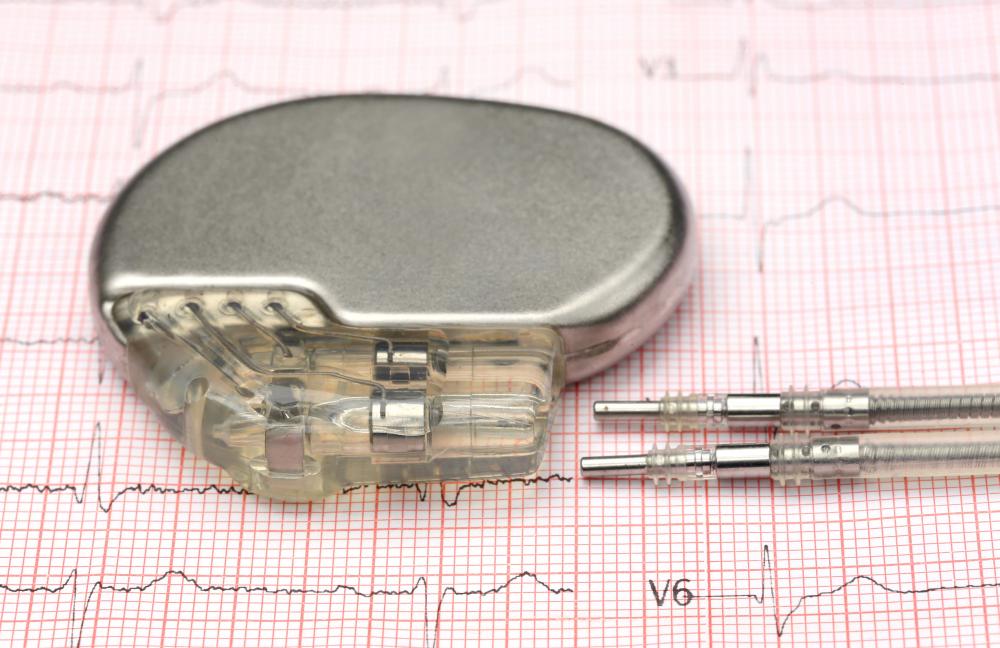 Pacemaker Pacemaker