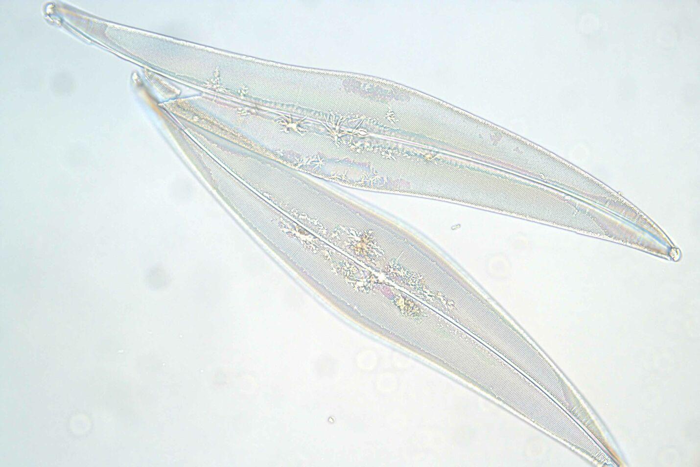 Diatoms imaged with leica k3